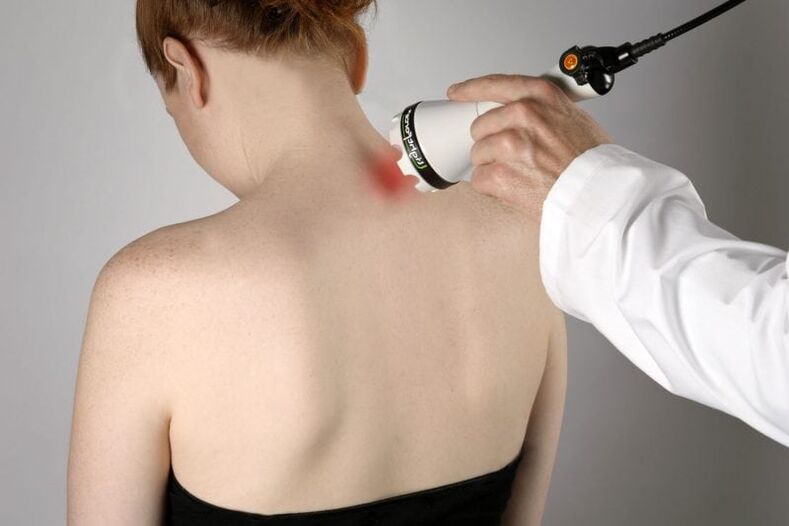 Sieviešu dzemdes kakla osteohondrozes ārstēšana ar lāzeru